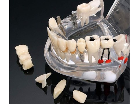 Edukacyjny model stomatologiczny do nauki anatomii zębów