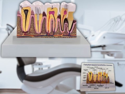 Model anatomiczny zęba stomatologiczny edukacyjny przekrój wyjmowany ząb